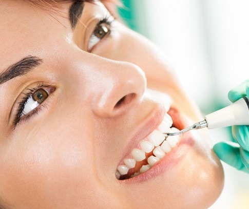 limpieza dental